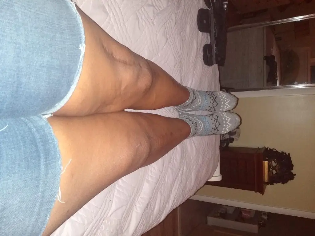 Knock Knee Valerie Bridges